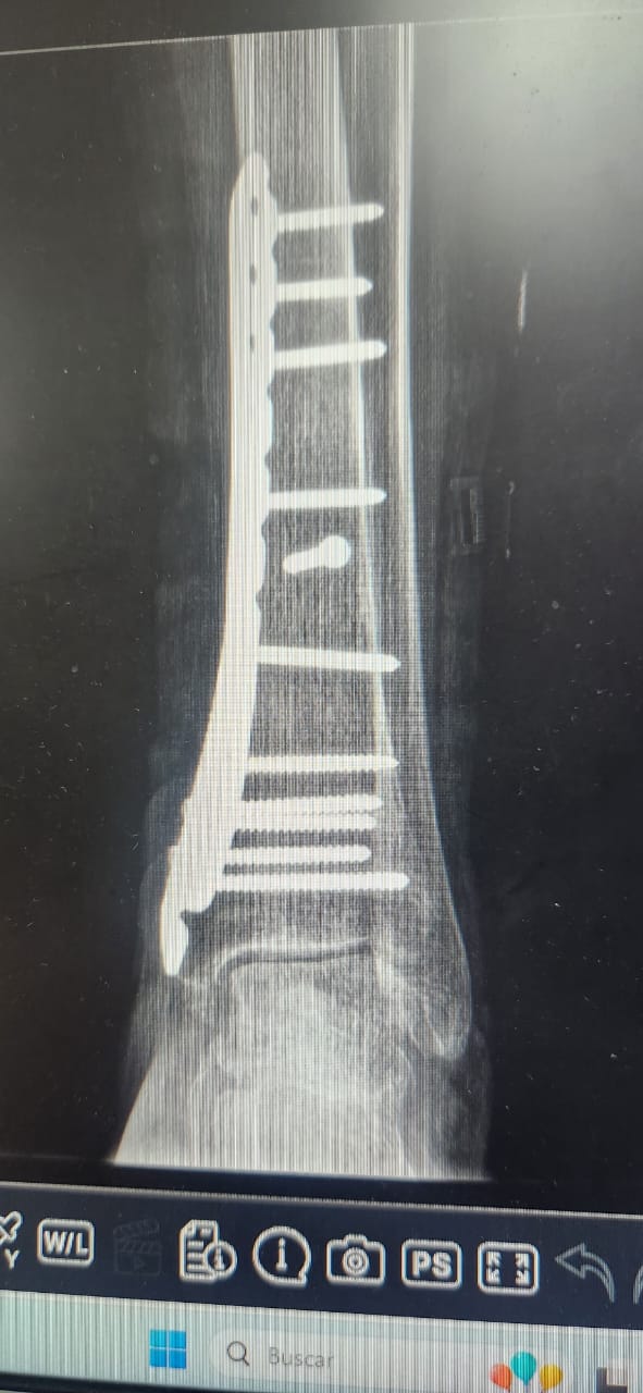 Traumatología
